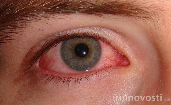 Глаза под марихуаной